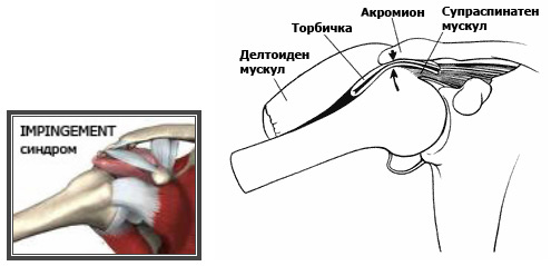 раменна става