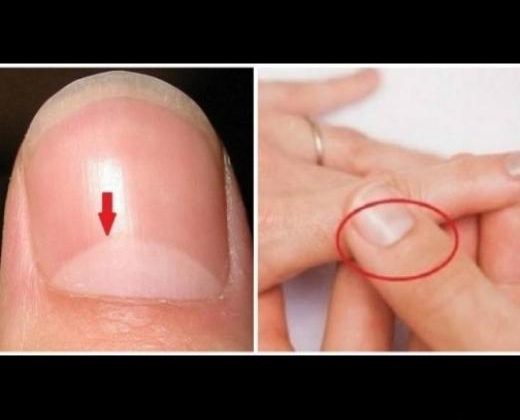 Имате ли бял полумесец на нокътя? Ако не – внимавайте!
