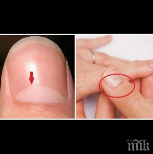 Имате ли бял полумесец на нокътя? Ако не – внимавайте!