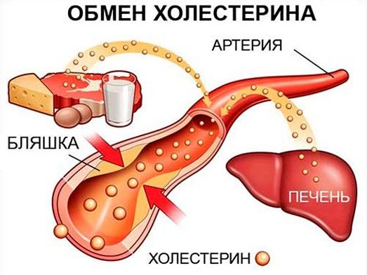 Холестерол: Причини и средства за лечение на висок холестерол