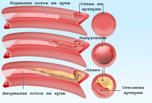 Холестерол: Наистина ли знаете всичко за него?